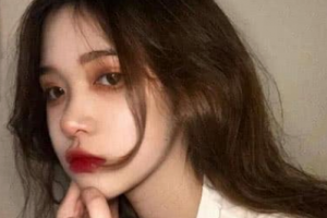 衡陽雅韓醫(yī)療美容醫(yī)院卓為慶整形價格表附玻尿酸精華導入案例展示