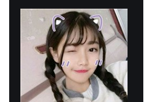 衡陽愛爾眼科醫(yī)院劉心紅整形價格表附切開雙眼皮案例展示