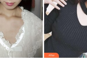 杭州華山連天美醫(yī)療美容整形醫(yī)院馮國松整形價(jià)格表附隆胸案例展示