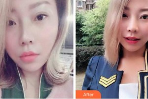 杭州華山連天美醫(yī)療美容整形醫(yī)院吳國興整形價(jià)格表附牙齒隱形矯正案例展示