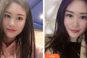 廣州愛康健口腔門診部韋秋紅整形價格表附冷光美白案例展示