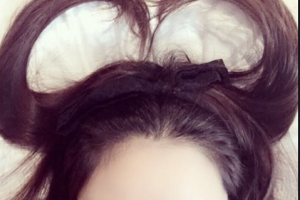 衡陽愛爾眼科醫(yī)院羅君整形價格表附眼部綜合案例展示