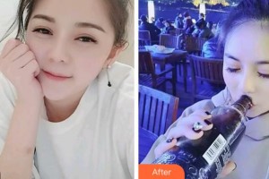 杭州愛琴海醫(yī)療美容醫(yī)院陸敏整形價格表附冷光美白案例展示