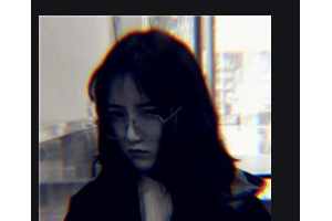 邵陽(yáng)愛(ài)爾眼科醫(yī)院謝建國(guó)整形價(jià)格表附眼部綜合案例展示