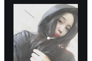 邵陽(yáng)愛(ài)爾眼科醫(yī)院楊明軒整形價(jià)格表附外切祛眼袋案例展示