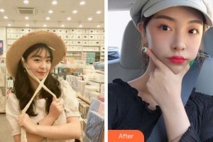 杭州整形醫(yī)院楊甄宇整形價(jià)格表附熱拉提案例展示