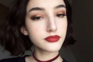 岳陽美蒂珂醫(yī)療美容門診部甘耀鵬整形價(jià)格表附光子嫩膚案例展示