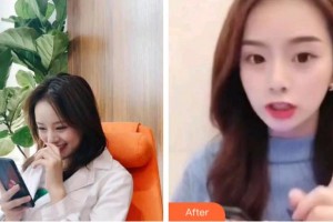 杭州維多利亞醫(yī)療美容醫(yī)院黃仁輝整形價(jià)格表附超聲波潔牙案例展示