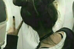 常德華山醫(yī)院整形美容中心李正烈整形價格表附自體脂肪填充額頭案例展示