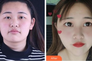 杭州麗欣醫(yī)療美醫(yī)院柯澤紅整形價(jià)格表附眼部綜合案例展示