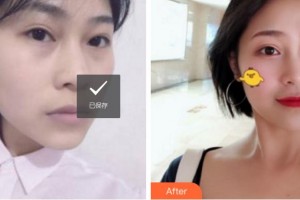 杭州麗星醫(yī)療美容診所汪世元整形價(jià)格表附埋線提升案例展示