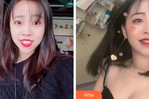 杭州美奧口腔門(mén)診部紀(jì)鳳賀整形價(jià)格表附金屬托槽矯正案例展示