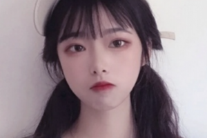 益陽德美整形醫(yī)院周超整形價格表附金屬托槽矯正案例展示