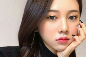 益陽市中心醫(yī)院美容整形科劉安久整形價格表附玻尿酸墊下巴案例展示