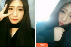 杭州品凱口腔醫(yī)院許晶整形價(jià)格表附牙齒隱形矯正案例展示