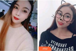 杭州亮貝美口腔醫(yī)院李詩佩整形價(jià)格表附牙貼面案例展示