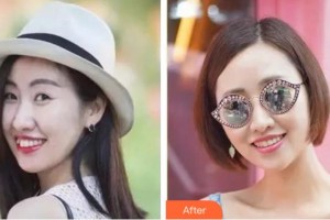 杭州良渚口腔門(mén)診部毛俏蕾整形價(jià)格表附隱形托槽矯正案例展示