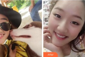 杭州博凡口腔門(mén)診部張弘整形價(jià)格表附牙齒隱形矯正案例展示