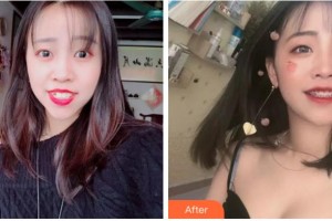 杭州博凡口腔門(mén)診部賈旭整形價(jià)格表附金屬托槽矯正案例展示