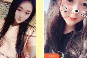 杭州西湖口腔醫(yī)院李國(guó)清整形價(jià)格表附美白劑美白牙齒案例展示