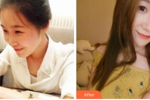 寧波尚麗整形美容醫(yī)院朱紅霞整形價(jià)格表附熱瑪吉案例展示