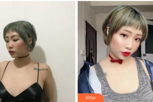 寧波同仁婦科醫(yī)院整形美容科胡繼來(lái)整形價(jià)格表附自體脂肪隆胸案例展示