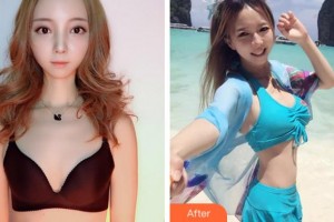 寧波珈禾整形?？漆t(yī)院雷中元整形價(jià)格表附自體脂肪隆胸案例展示