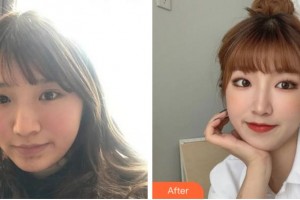 寧波鄔立新醫(yī)療美容診所黃燕麗整形價(jià)格表附激光祛斑案例展示