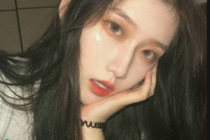 懷化愛爾眼科醫(yī)院蒲海生整形價格表附切開雙眼皮案例展示