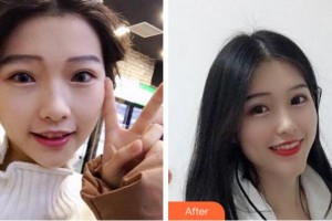 寧波薇琳醫(yī)療美容門診部文承真整形價格表附牙齒隱形矯正案例展示