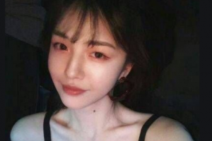 懷化博奧口腔診所陳明整形價格表附金屬托槽矯正案例展示