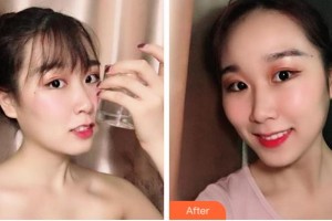 寧波拜博拜爾口腔醫(yī)院高輝整形價格表附牙齒隱形矯正案例展示