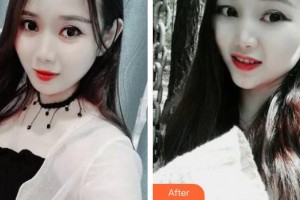 寧波市眼科醫(yī)院吳善君整形價格表附牙齒隱形矯正案例展示