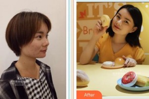 寧波千口百惠口腔門診部程海標(biāo)整形價格表附牙齒隱形矯正案例展示