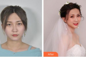 寧波明州醫(yī)院眼科余亞波整形價格表附眼部綜合案例展示