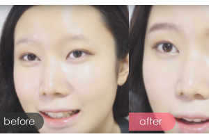 深圳鵬程醫(yī)院整形美容中心劉卓雅整形價(jià)格表附紋眉案例展示