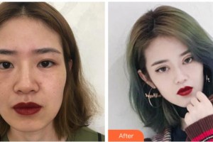 溫州雅美姬整形美容醫(yī)院尹卿準整形價格表附眼部綜合案例展示