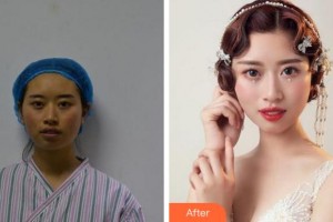 溫州藝星醫(yī)學美容醫(yī)院黃艷軍整形價格表附抗衰案例展示