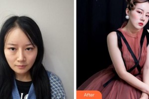 溫州永嘉東方整形外科門診部陳金西整形價(jià)格表附鼻部綜合案例展示