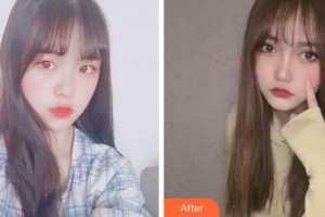 溫州芘麗芙美容醫(yī)院程軍整形價(jià)格表附開內(nèi)眼角案例展示