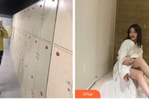 溫州伯思立醫(yī)院醫(yī)療美容科劉李娜整形價(jià)格表附吸脂案例展示