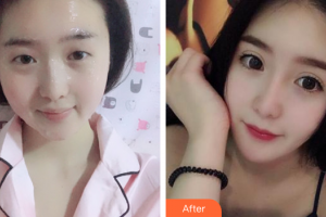 深圳易容顏醫(yī)療美容門診部魏曉峰整形價格表附仿生翹睫雙眼皮案例展示