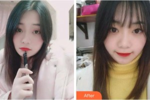 溫州醫(yī)科大學(xué)附屬口腔學(xué)院魏利敏整形價(jià)格表附牙齒隱形矯正案例展示