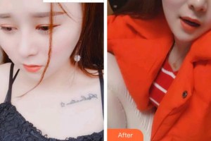 溫州醫(yī)科大學(xué)附屬口腔學(xué)院梅麗琴整形價(jià)格表附超聲波潔牙案例展示