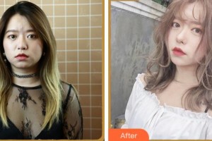 溫州醫(yī)科大學(xué)附屬眼視光醫(yī)院沈麗君整形價格表附眼部綜合案例展示