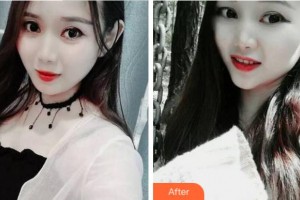 溫州藍(lán)芽口腔門診部楊新新整形價格表附牙齒隱形矯正案例展示