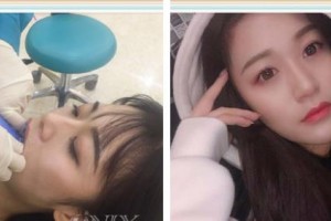 嘉興口腔醫(yī)院米蘭整形價(jià)格表附牙齒隱形矯正案例展示