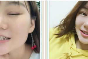 嘉興牙博士口腔門診部馬楠整形價(jià)格表附牙齒隱形矯正案例展示