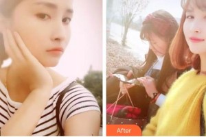 湖州金鉑利口腔門診部增強整形價格表附美白劑美白牙齒案例展示