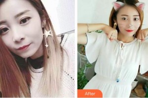 湖州溫馨口腔診所張敏秀整形價格表附牙齒隱形矯正案例展示